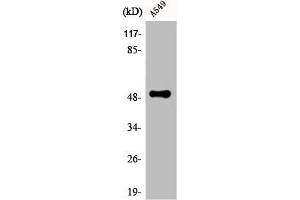 Western Blot analysis of A549 cells using CPM Polyclonal Antibody (CPM Antikörper  (Internal Region))
