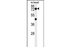 PHTF2 Antibody (Center) (ABIN654395 and ABIN2844137) western blot analysis in mouse heart tissue lysates (15 μg/lane). (PHTF2 Antikörper  (AA 420-448))