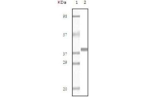 Western blot analysis using Myoglobin antibody against truncated Myoglobin recombinant protein (AA: 2-154). (Myoglobin Antikörper)