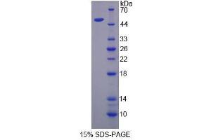 Image no. 1 for Semenogelin I (SEMG1) (AA 24-462) protein (His tag) (ABIN6240010)