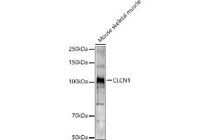 Western blot analysis of extracts of Mouse skeletal muscle, using CLCN1 antibody (ABIN6130939, ABIN6138661, ABIN6138662 and ABIN6221409) at 1:1000 dilution. (CLCN1 Antikörper  (AA 779-988))