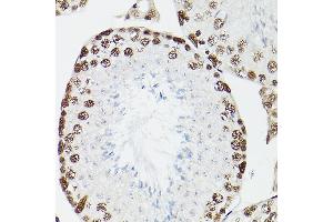 Immunohistochemistry of paraffin-embedded rat testis using CPSF6 Rabbit pAb (ABIN6128924, ABIN6138974, ABIN6138975 and ABIN6221646) at dilution of 1:100 (40x lens). (CPSF6 Antikörper)