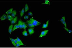 Immunofluorescent analysis of Hela cells using ABIN7174579 at dilution of 1:100 and Alexa Fluor 488-congugated AffiniPure Goat Anti-Rabbit IgG(H+L) (UBE2L6 Antikörper  (AA 13-153))