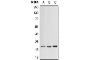 Western blot analysis of MRPL12 expression in HeLa (A), SP2/0 (B), H9C2 (C) whole cell lysates.