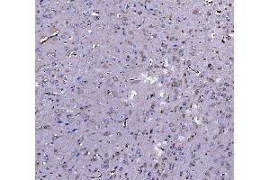 IHC analysis of EEF2/Elongation factor 2 using anti-EEF2/Elongation factor 2 antibody (ABIN7603142).