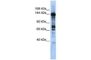 WB Suggested Anti-CASZ1 Antibody Titration:  0. (CASZ1 Antikörper  (Middle Region))