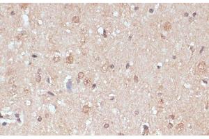Immunohistochemistry of paraffin-embedded Rat brain using NAA20 Polyclonal Antibody at dilution of 1:100 (40x lens). (NAT5 Antikörper)