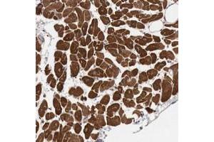Immunohistochemical staining of human heart muscle with KIF21B polyclonal antibody  shows strong cytoplasmic positivity in myocytes at 1:50-1:200 dilution.