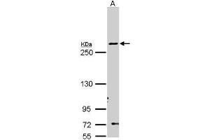 WB Image Sample (30 ug of whole cell lysate) A: Molt-4 , 5% SDS PAGE antibody diluted at 1:1000 (Fatty Acid Synthase Antikörper  (N-Term))
