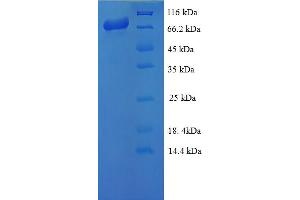 SDS-PAGE (SDS) image for Doublecortin-Like Kinase 1 (DCLK1) (AA 1-754), (full length) protein (His-SUMO Tag) (ABIN5711159) (DCLK1 Protein (AA 1-754, full length) (His-SUMO Tag))