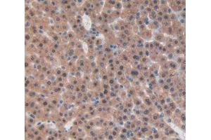 IHC-P analysis of liver tissue, with DAB staining. (beta-Thromboglobulin Antikörper  (AA 46-107))