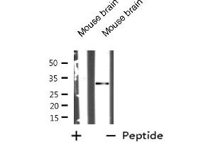 Western blot analysis of MARCKS expression in Mouse brain tissue lysates,The lane on the left is treated with the antigen-specific peptide. (MARCKS Antikörper  (Internal Region))
