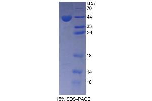SDS-PAGE analysis of Rat AGTR1 Protein. (Angiotensin II Type-1 Receptor Protein)