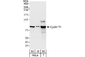 Western Blotting (WB) image for anti-Cyclin T1 (CCNT1) (AA 325-375) antibody (ABIN7453623)
