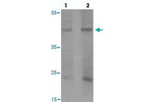 Western blot analysis of PELI1 in human liver tissue with PELI1 polyclonal antibody  at (1) 1 and (2) 2 ug/mL. (Pellino 1 Antikörper  (C-Term))