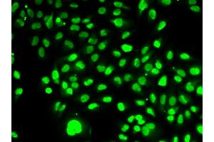Immunofluorescence analysis of HeLa cells using NAMPT antibody. (NAMPT Antikörper)