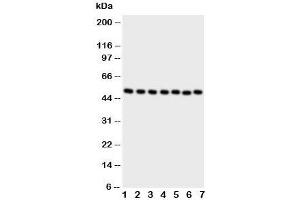 Western blot testing of CTBP2 antibody and Lane 1:  rat brain;  2: rat spleen ;  3: HeLa;  4: 293T;  5: COLO320;  6: U87;  7: SW620 cell lysate (CTBP2 Antikörper  (C-Term))