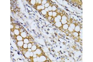 Immunohistochemistry of paraffin-embedded Human colon using CCDC92 Polyclonal Antibody at dilution of 1:100 (40x lens). (CCDC92 Antikörper)