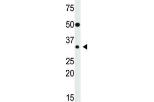 Western Blotting (WB) image for anti-Snail Family Zinc Finger 2 (SNAI2) (AA 98-129) antibody (ABIN3032658)