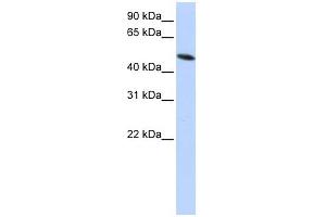 PDIA6 antibody used at 1 ug/ml to detect target protein. (PDIA6 Antikörper  (Middle Region))