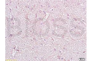 Formalin-fixed and paraffin embedded rat brain tissue with labeled Anti-CD38 Polyclonal Antibody, Unconjugated (ABIN730498) at 1:200, followed by conjugation to the secondary antibody and DAB staining (CD38 Antikörper  (AA 101-200))