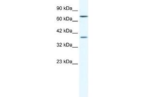 Western Blot showing ZNF660 antibody used at a concentration of 1-2 ug/ml to detect its target protein. (ZNF660 Antikörper  (C-Term))