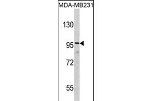Western blot analysis of DLG Antibody (N-term) (ABIN390832 and ABIN2841058) in MDA-M cell line lysates (35 μg/lane). (DLGAP1 Antikörper  (N-Term))