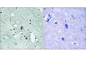Immunohistochemistry analysis of paraffin-embedded human brain, using IP3R1 (Phospho-Ser1764) Antibody. (ITPR1 Antikörper  (pSer1764))