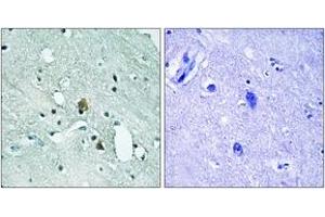 Immunohistochemistry analysis of paraffin-embedded human brain, using IP3R1 (Phospho-Ser1764) Antibody.
