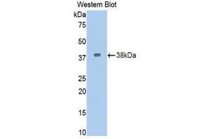 Western Blotting (WB) image for anti-Insulin Receptor (INSR) (AA 622-945) antibody (ABIN3207587) (Insulin Receptor Antikörper  (AA 622-945))