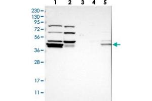 Western blot analysis of Lane 1: RT-4, Lane 2: U-251 MG, Lane 3: Human Plasma, Lane 4: Liver, Lane 5: Tonsil with RDBP polyclonal antibody  at 1:250-1:500 dilution. (RDBP Antikörper)