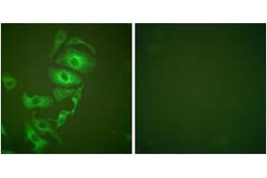 Immunofluorescence analysis of HepG2 cells, using Keratin 17 Antibody. (KRT17 Antikörper  (AA 381-430))