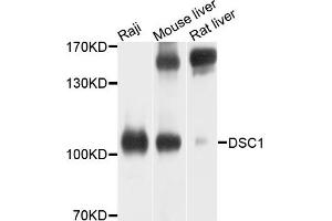 Western blot analysis of extracts of various cells, using DSC1 antibody. (Desmocollin 1 Antikörper)