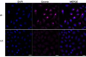Immunocytochemical staining of HeLa cells using Desmin antibody (ABIN7798314), 1:1,000), Top panel: wild-type (WT), Bottom panal: Desmin shRNA knockdown (KD).