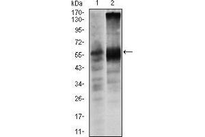 Western blot analysis using SOX9 mouse mAb against Lovo (1) and SW620 (2) cell lysate. (SOX9 Antikörper)