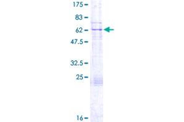 KATNA1 Protein (AA 1-311) (GST tag)