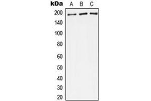 Western blot analysis of Complement C4A/B expression in A549 (A), Raw264. (Complement C4A/C4B (Center) Antikörper)