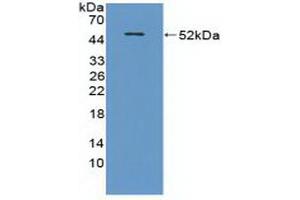 Western blot analysis of recombinant Mouse CRAT. (CRAT Antikörper  (AA 1-430))