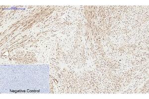 Immunohistochemical analysis of paraffin-embedded human uterus tissue. (PERK Antikörper  (pThr981))