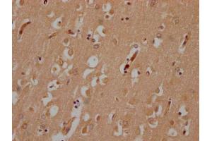 IHC image of ABIN7174973 diluted at 1:200 and staining in paraffin-embedded human brain tissue performed on a Leica BondTM system. (Myosin XV (MYO15) (AA 237-451) Antikörper)
