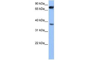 WB Suggested Anti-ZCCHC12 Antibody Titration: 0. (ZCCHC12 Antikörper  (N-Term))