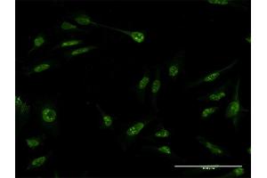 Immunofluorescence of monoclonal antibody to SUMO3 on HeLa cell.