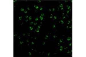 Immunofluorescence of ASK1 in 3T3 cells with AP30086PU-N ASK1 antibody at 20 μg/ml. (ASK1 Antikörper)