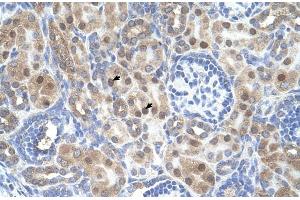 Human kidney; ARMCX6 antibody - N-terminal region in Human kidney cells using Immunohistochemistry (ARMCX6 Antikörper  (N-Term))