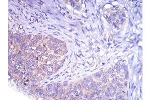 Immunohistochemistry (IHC) image for anti-TH (AA 44-208) antibody (ABIN5858376) (TH Antikörper  (AA 44-208))