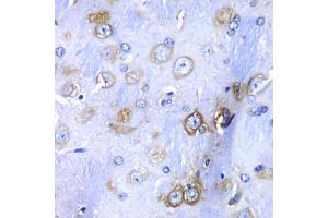 Immunohistochemistry of paraffin-embedded mouse brain using RPS3A Antibody (ABIN5973489) at dilution of 1/100 (40x lens). (RPS3A Antikörper)