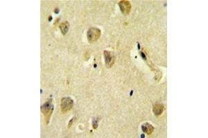 Immunohistochemistry (Paraffin-embedded Sections) (IHC (p)) image for anti-Protein Phosphatase 1, Regulatory (Inhibitor) Subunit 14C (PPP1R14C) (AA 133-163), (C-Term) antibody (ABIN954270)