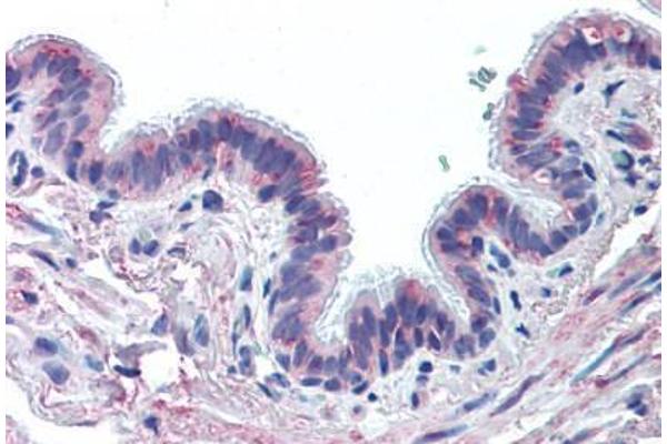 MUC13 Antikörper  (Extracellular Domain)