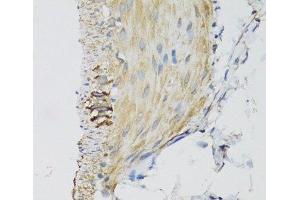Immunohistochemistry of paraffin-embedded Mouse stomach using DGUOK Polyclonal Antibody at dilution of 1:100 (40x lens). (Deoxyguanosine Kinase Antikörper)