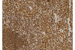 ABIN6275314 at 1/100 staining Mouse spleen tissue by IHC-P. (NUMA1 Antikörper  (N-Term))